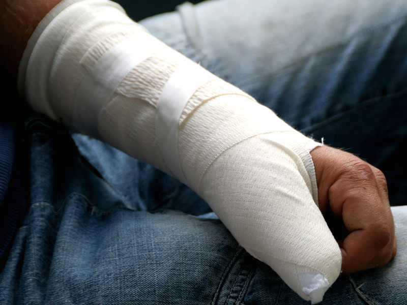 В Красноярском крае полицейские сломали руку прохожему, решив, что он пьян
