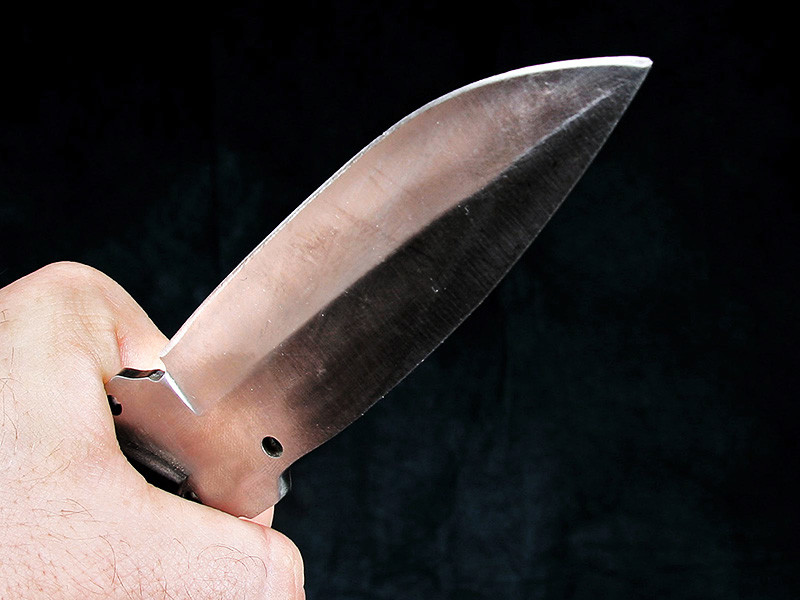 В США мужчину ранили ножом "за стрижку под нациста"
