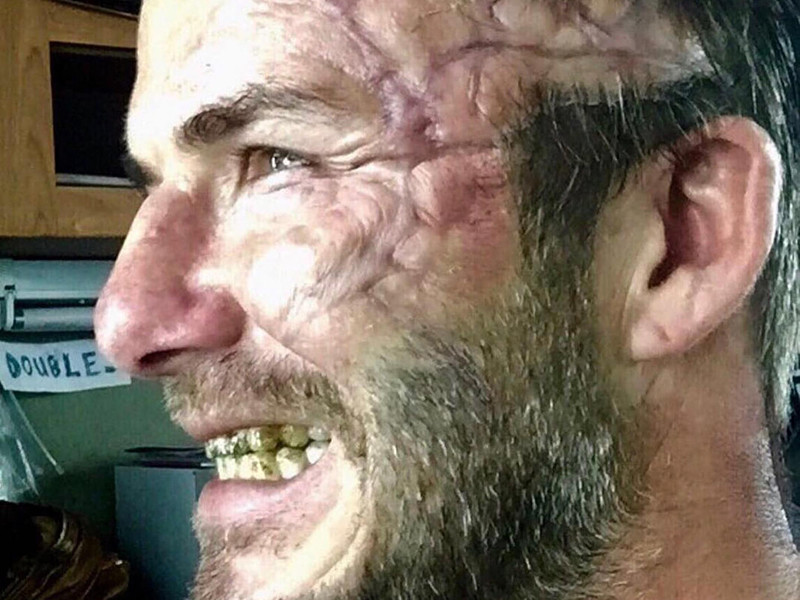 Известный спортсмен и начинающий актер Дэвид Бэкхем шокировал своих поклонников, опубликовав в Instagram фотографию с синюшным шрамом на все лицо, горбатым носом и выщербленными черными зубами