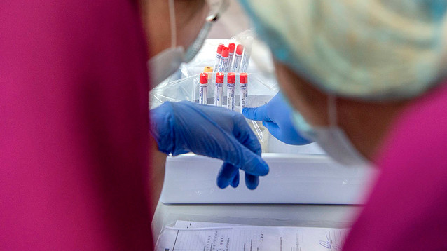 Минздрав признал, что до 30% ПЦР-тестов на Covid-19 недостоверны, и разрешил ставить диагноз по КТ