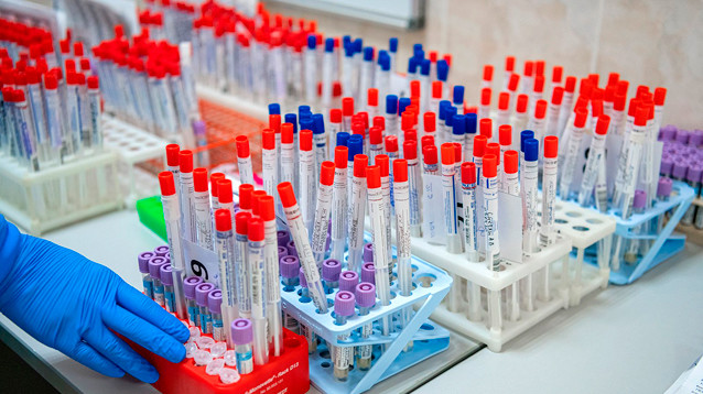 Ракова: тест на коронавирус обязателен для всех москвичей с признаками ОРВИ