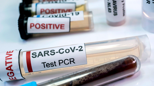 Врачи назвали, что формирует иммунитет к COVID-19, а что его рушит, грозя человеку смертью