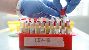 В России число случаев заболевания коронавирусом за сутки снова превысило 15 тысяч